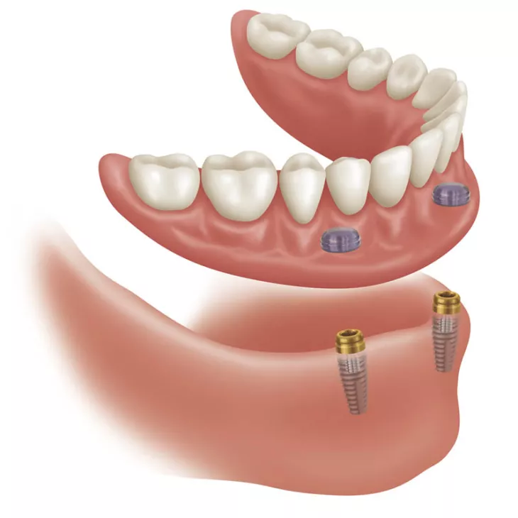 Dental image