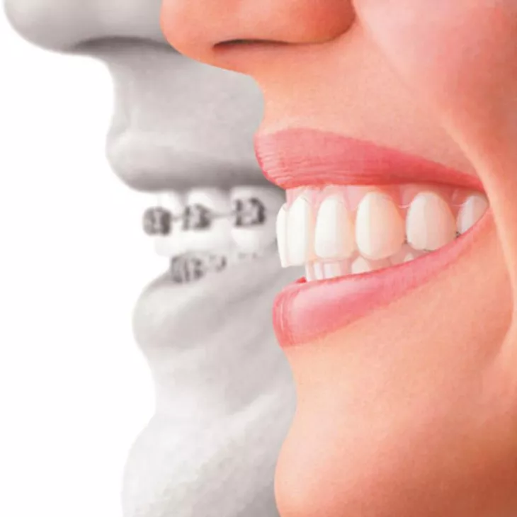 We're the top dental clinic for dental braces Dubai! 
