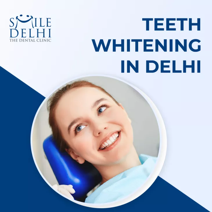 Teeth Whitening In Delhi