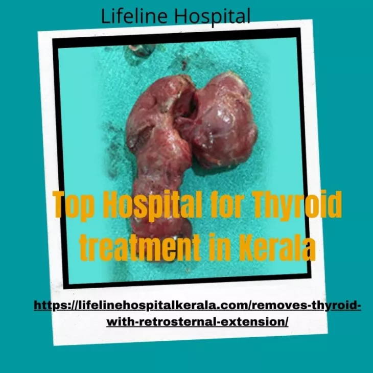 Top Hospital for Thyroid treatment in Kerala
