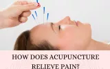 How does acupuncture relieve pain