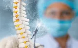 Thoracic spine fracture, nerve damage treatment
