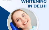 Teeth Whitening In Delhi