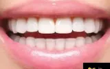 Best Teeth Whitening Treatment in Mogappair